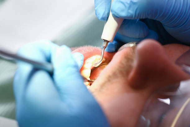Best Pediatric Emergency Dentist in Arlington Heights, PA